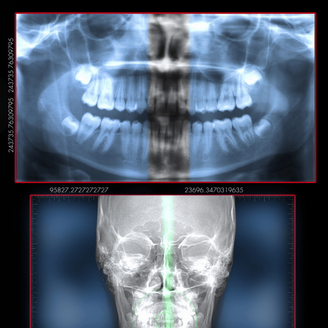 Modern Technology at Our Family Dental Practice in Mt. Pleasant SC Mouth and skull xray | Modern technology | Adult and Pediatric Dentist Mt. Pleasant SC