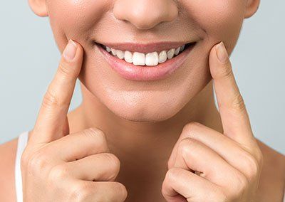 woman pointing to corners of her smile | teeth cleanings and check ups | dentist near Mt. Pleasant SC