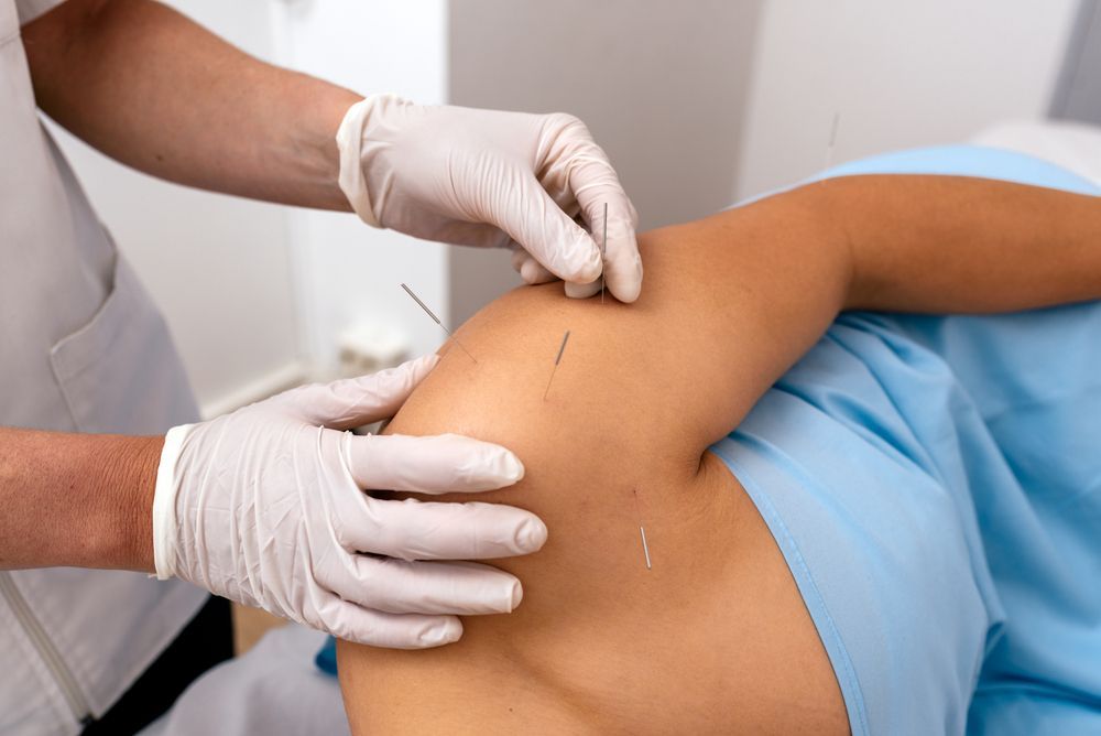 A practitioner wearing white gloves performs acupuncture on a patient's shoulder area with multiple needles inserted.