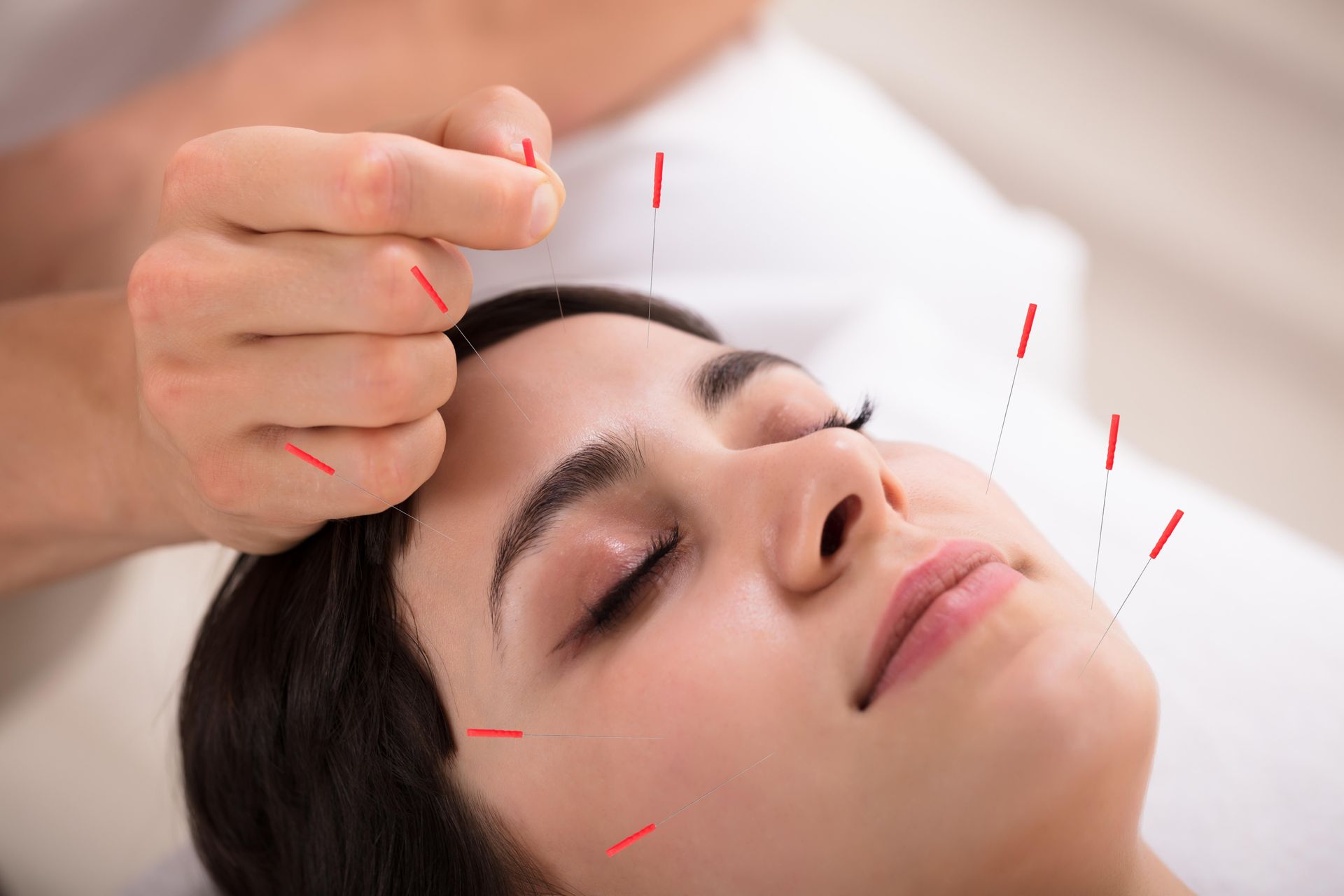 Person receiving facial acupuncture; close-up with needles inserted.