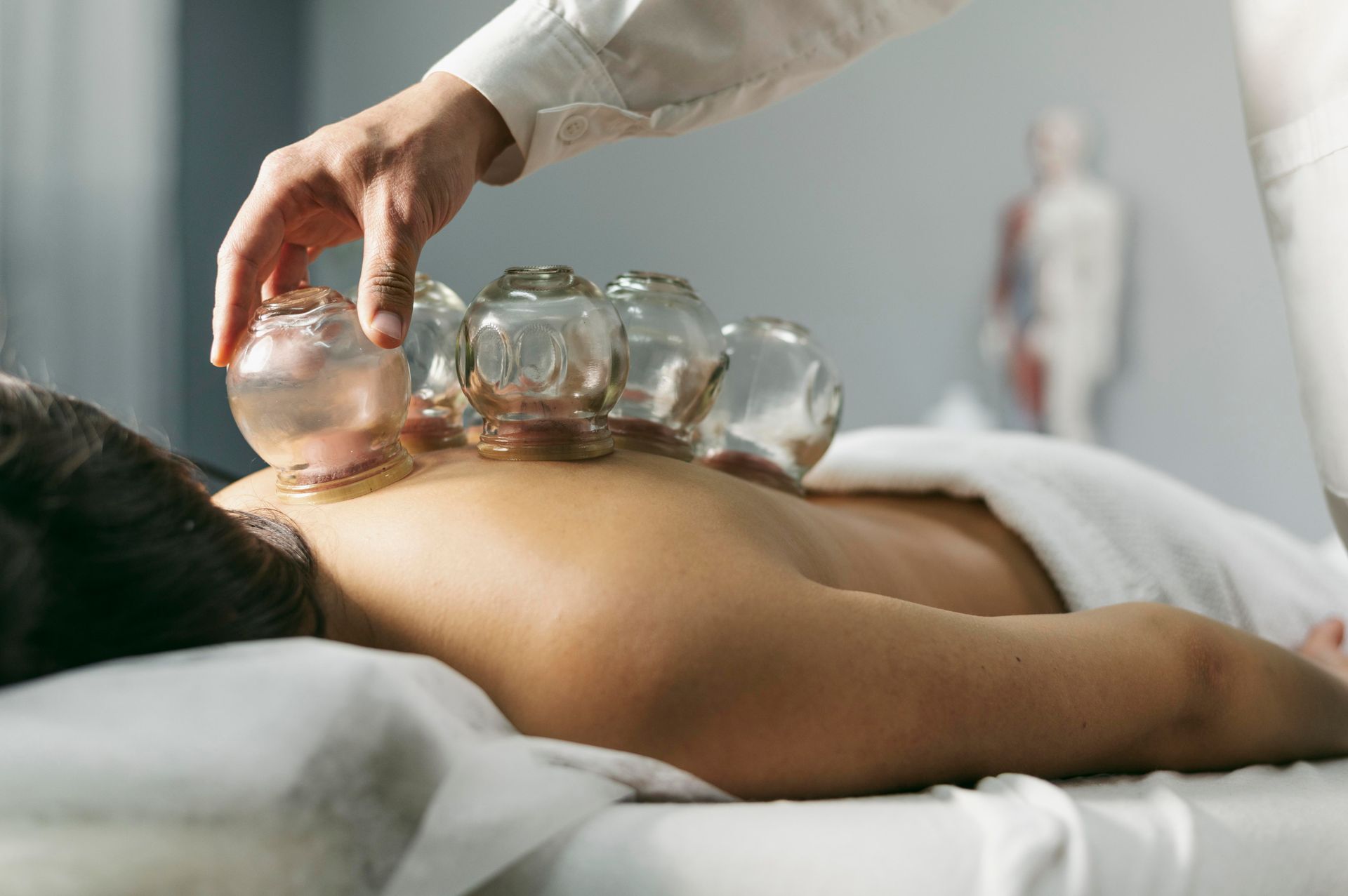 Person receiving cupping therapy on their back, clear glass cups applied.