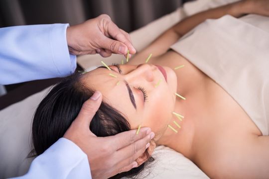 woman undergoing acupuncture face treatment