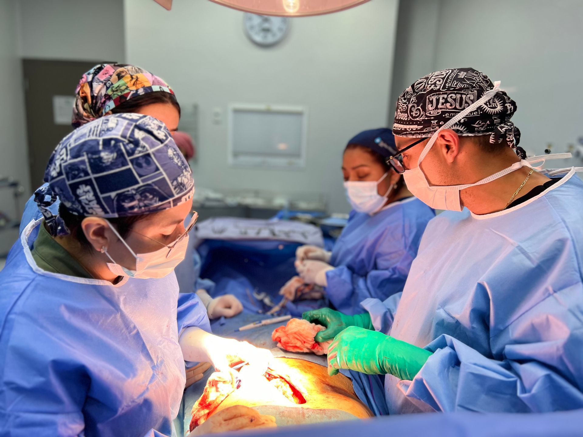 Cirugía Laparoscópica Avanzada