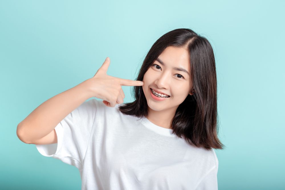 Woman with braces points to her mouth, smiling, against a light blue background. She wears a white shirt.