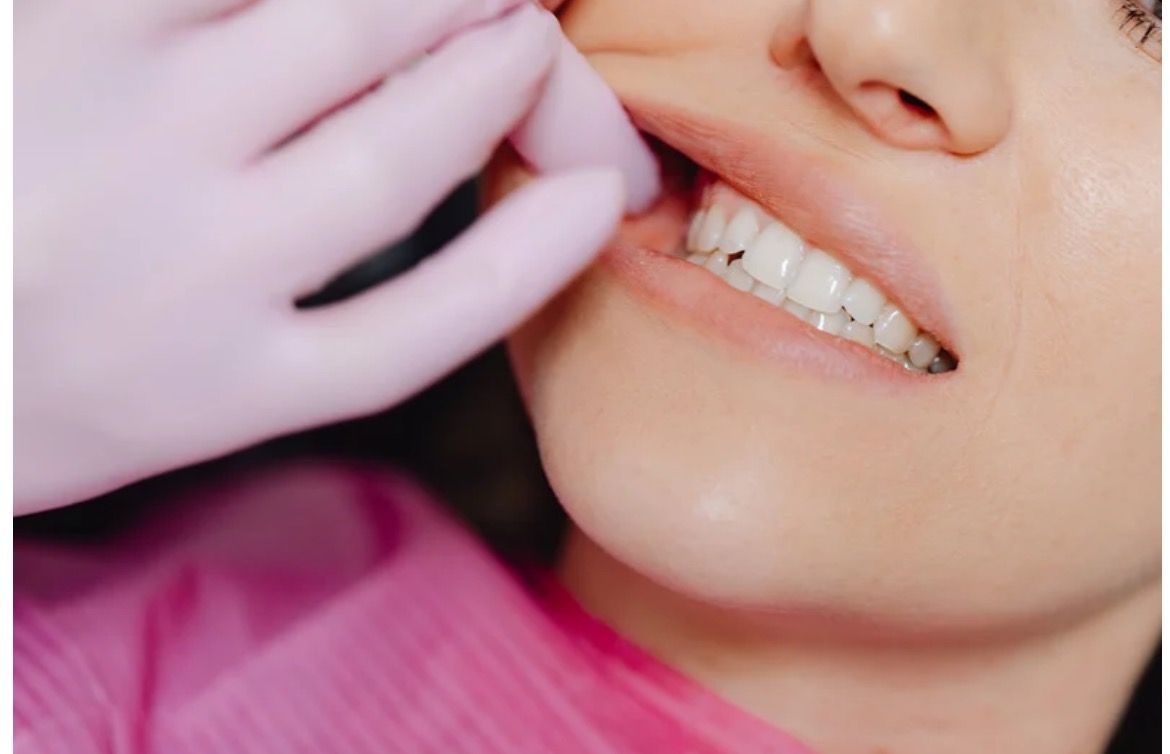 Close-up of a person smiling, showing teeth that are yellowed. The lips and skin have a pale tone.