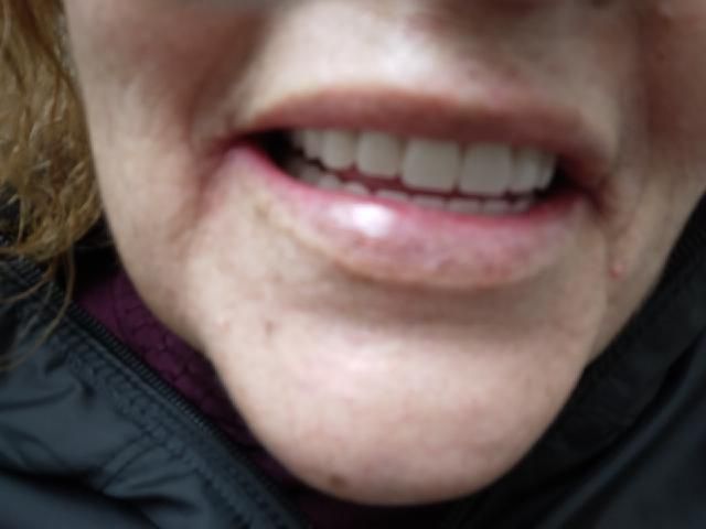Close-up of a person's smiling mouth showing straight, white teeth. The lips are lightly parted.