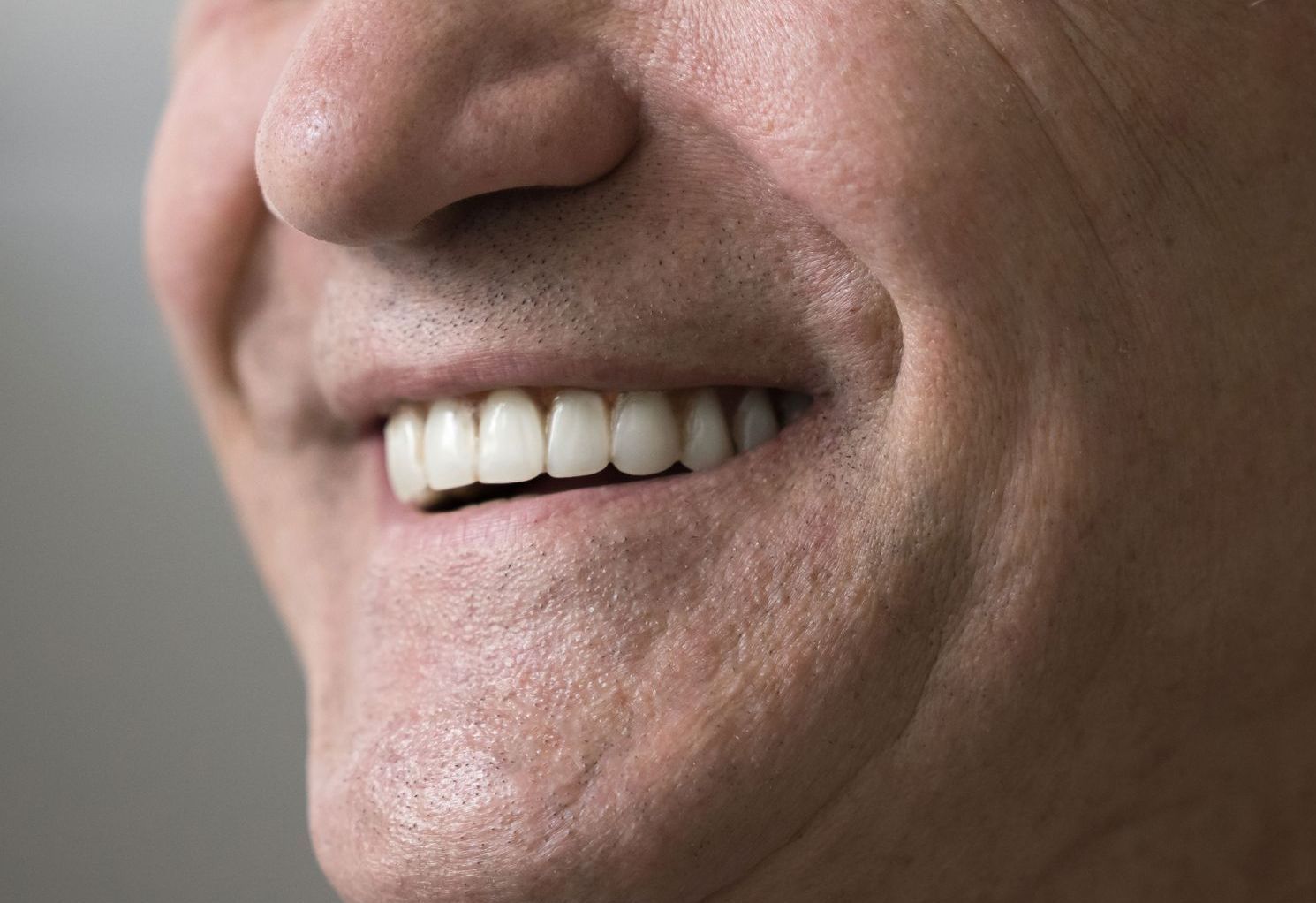 Close-up of a smiling mouth and nose with white teeth.