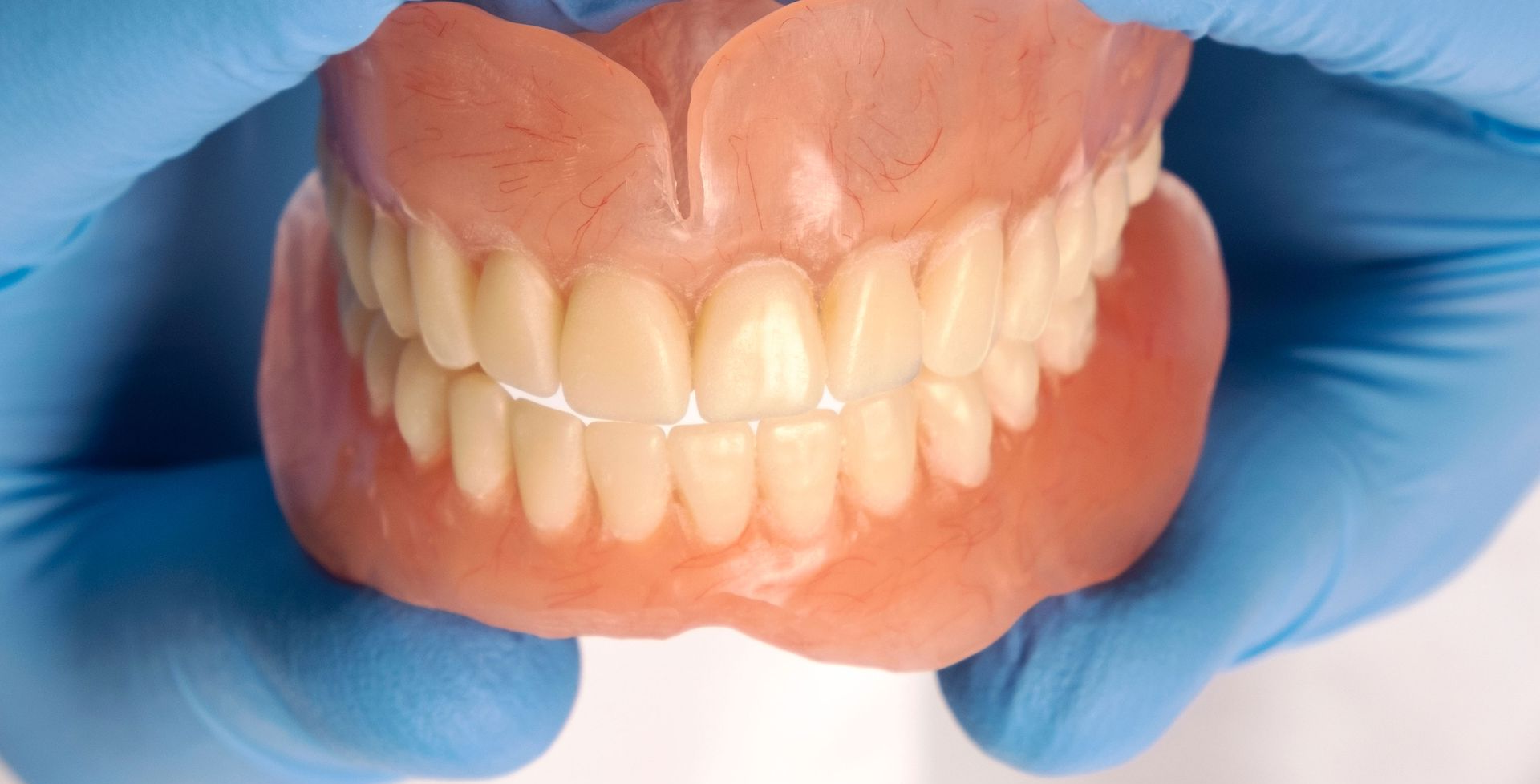 Dentures held by gloved hands, showcasing upper and lower artificial teeth.