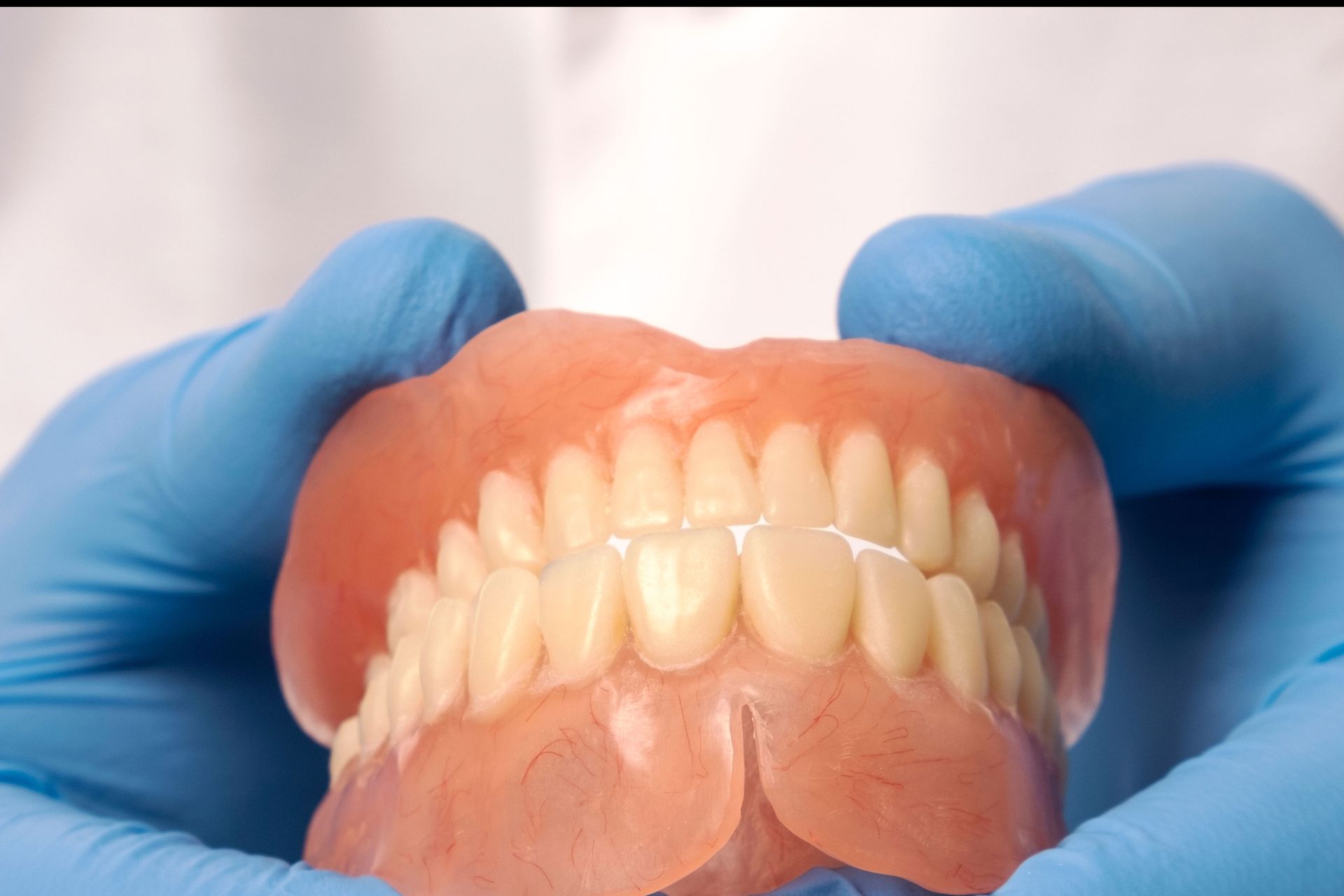 Hands in blue gloves holding a set of dentures.