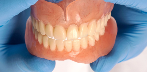Hands in blue gloves holding a set of dentures.