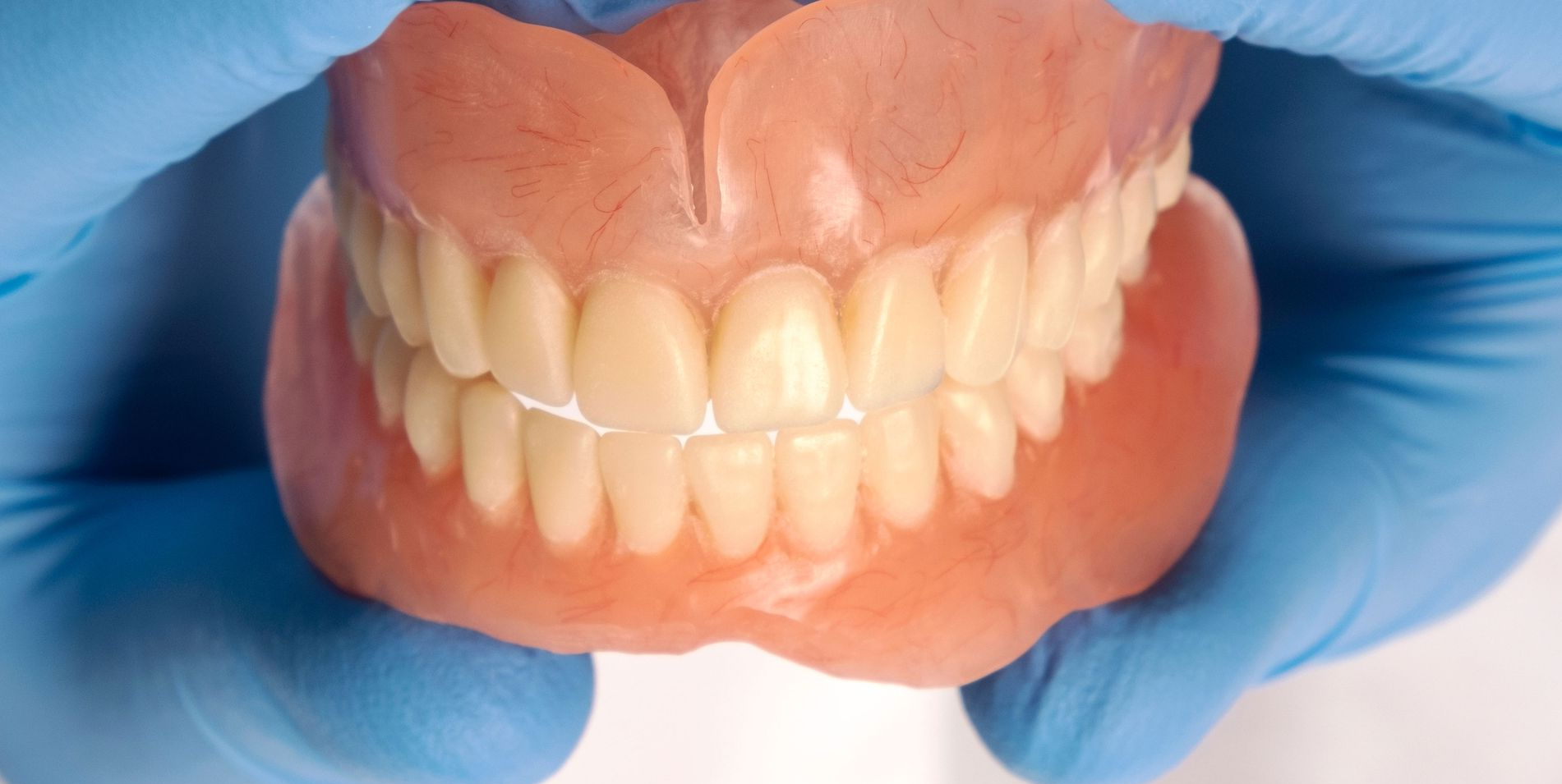 Hands in blue gloves holding a set of dentures.