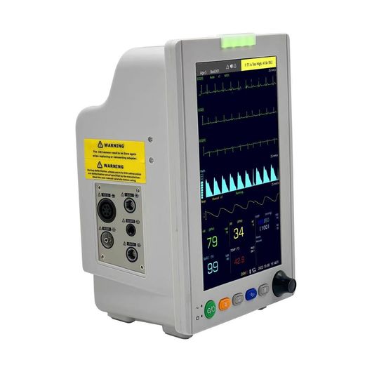 Medical monitor displaying vital signs: heart rate, SpO2, and blood pressure.
