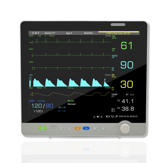 Medical monitor displaying vital signs: heart rate, SpO2, and blood pressure.