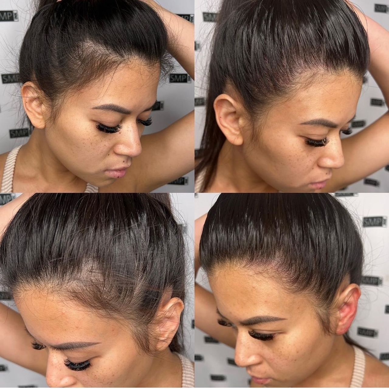 Four photos of a woman with dark hair, showing the hairline. Hair looks thicker in later photos.