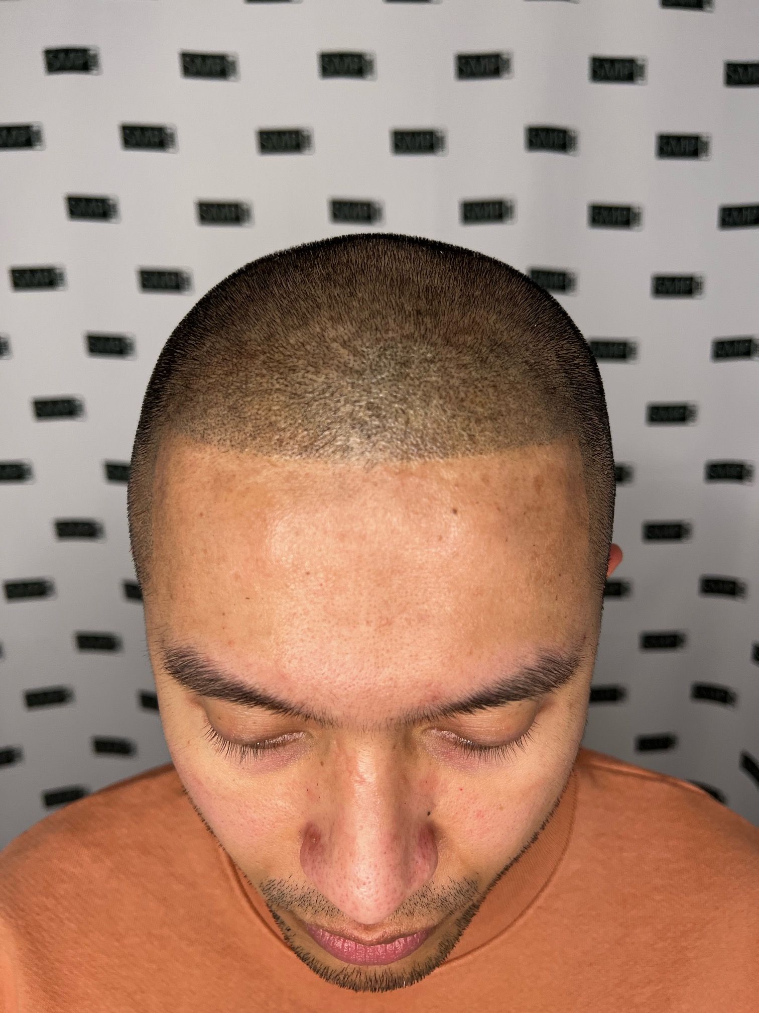 Man with short, buzzed hair, looking down. Wearing orange shirt, against black and white patterned background.