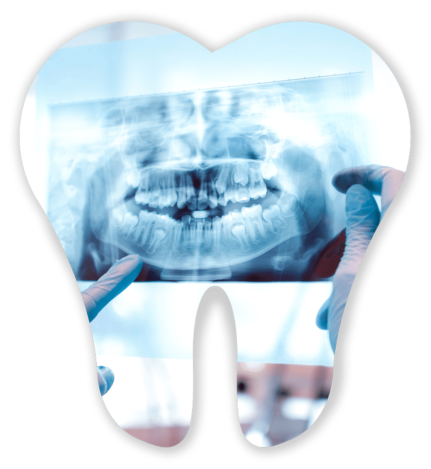 Full Detailed Dental X-Ray — Germantown, TN — Mark A. Skidmore, DDS