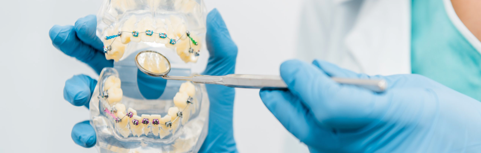 A dental model with braces is held by gloved hands. A dental mirror is held up to the model.