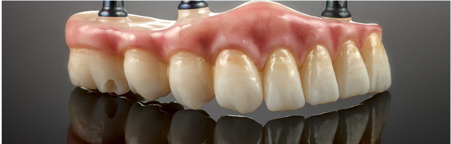 Close-up of dental implants with prosthetic teeth, on a reflective surface.