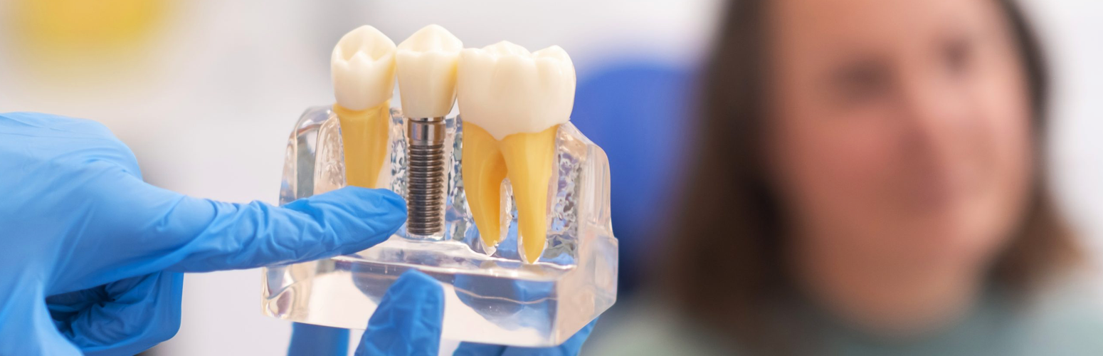 Dentist shows a tooth model with implant to a patient. Blue gloves, teeth in focus, patient blurred in background.