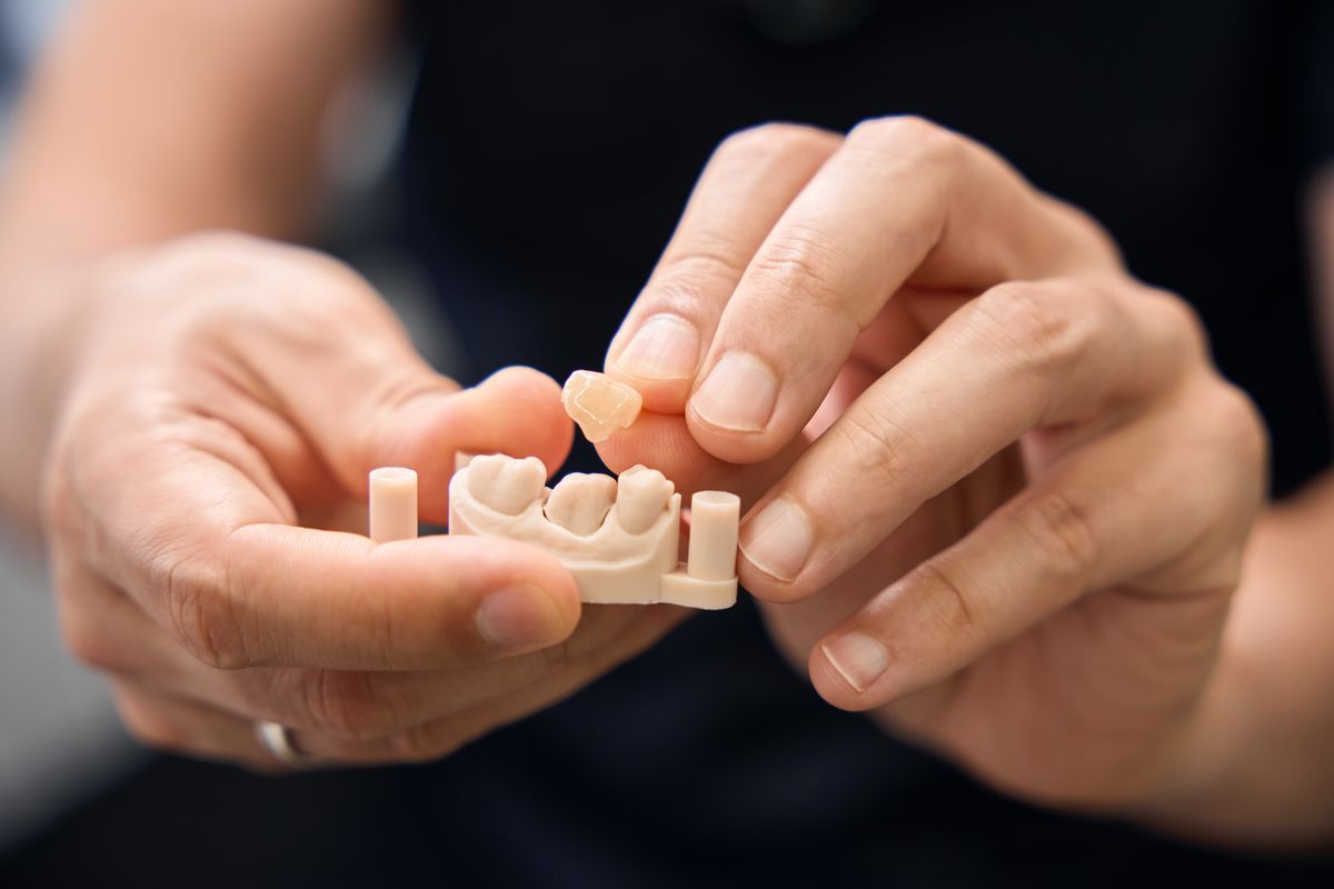 Hands holding a dental model with a single tooth crown being placed into position.