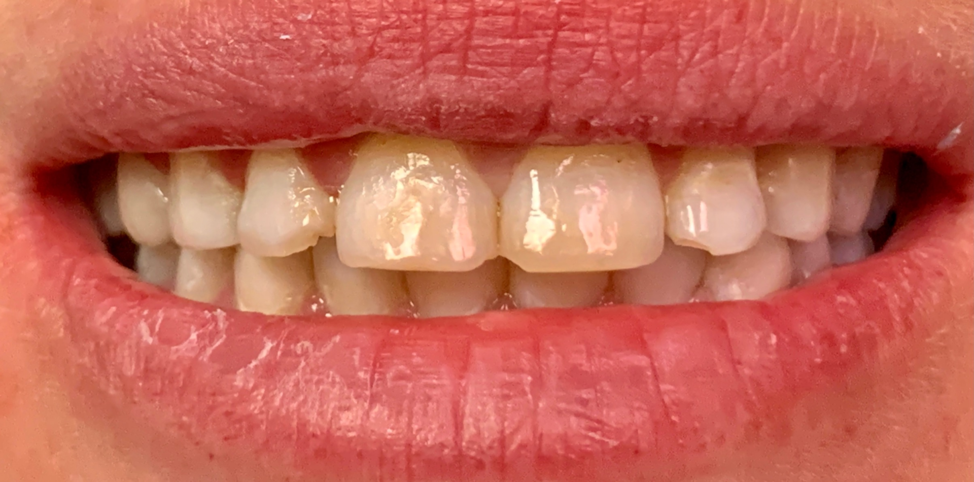 A close up of a person 's mouth with white teeth and red lips.