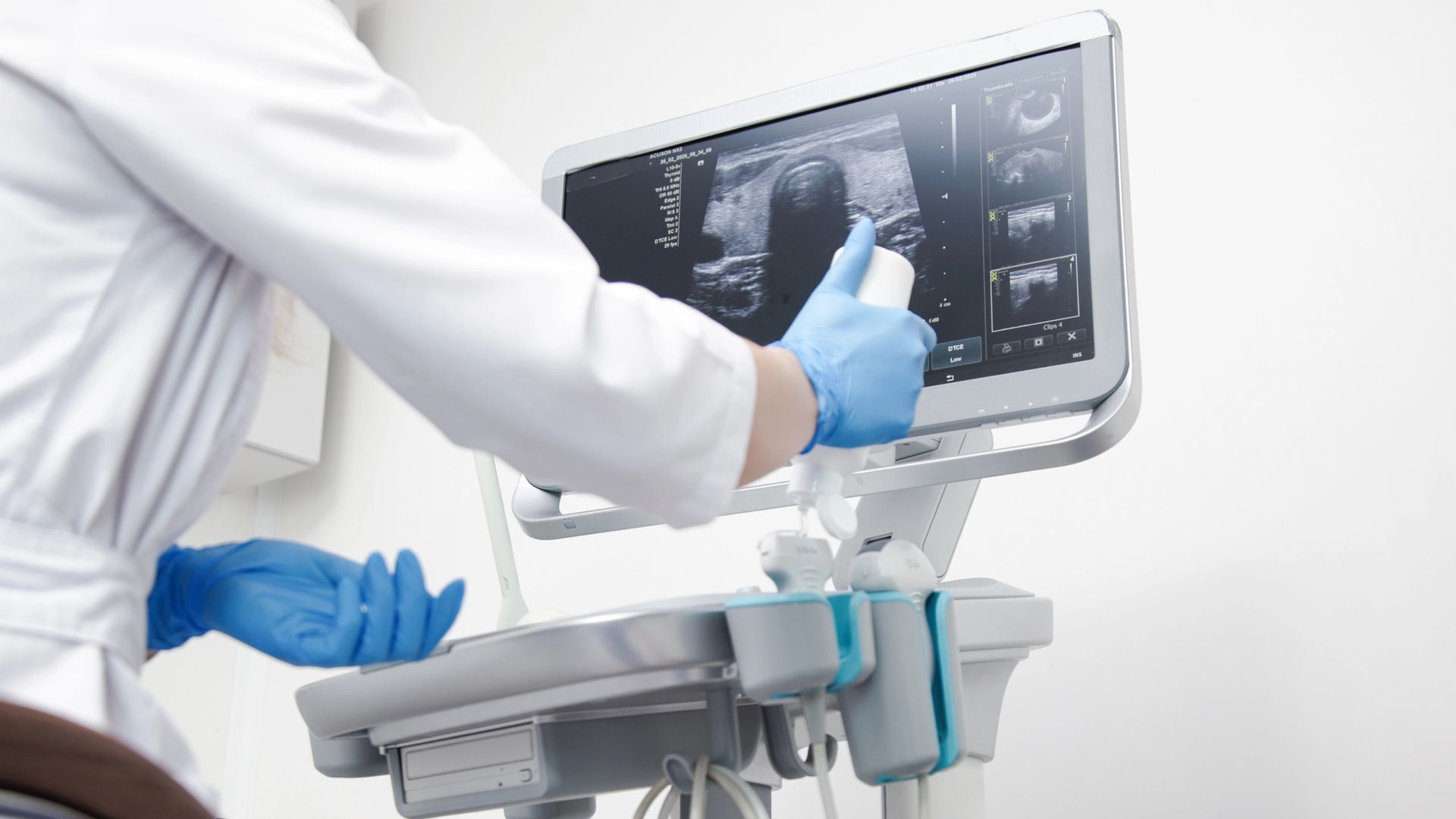 Un medico in camice bianco e guanti blu utilizza un ecografo e indica lo schermo che mostra una scansione medica.