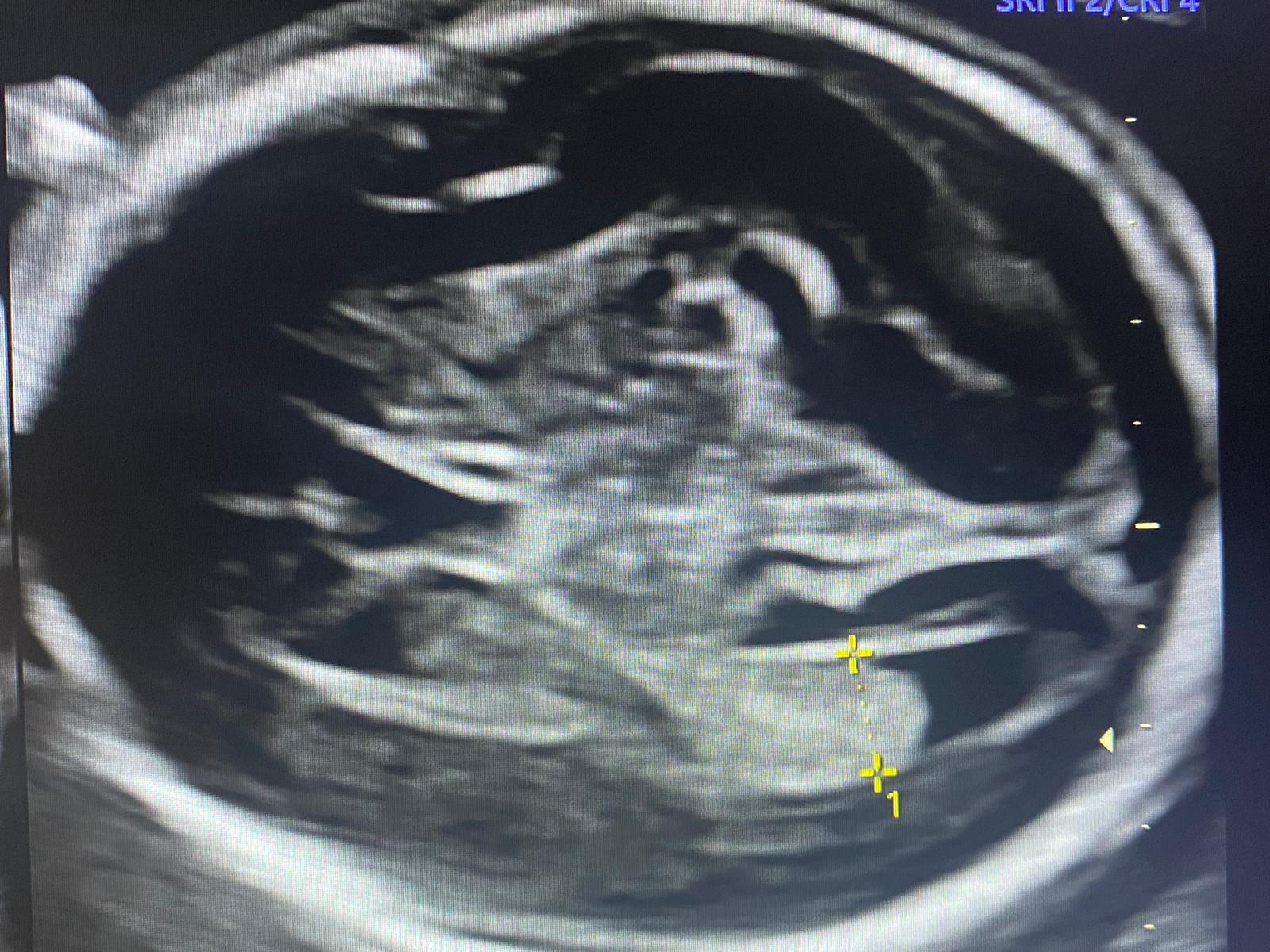 esami ecografici feto