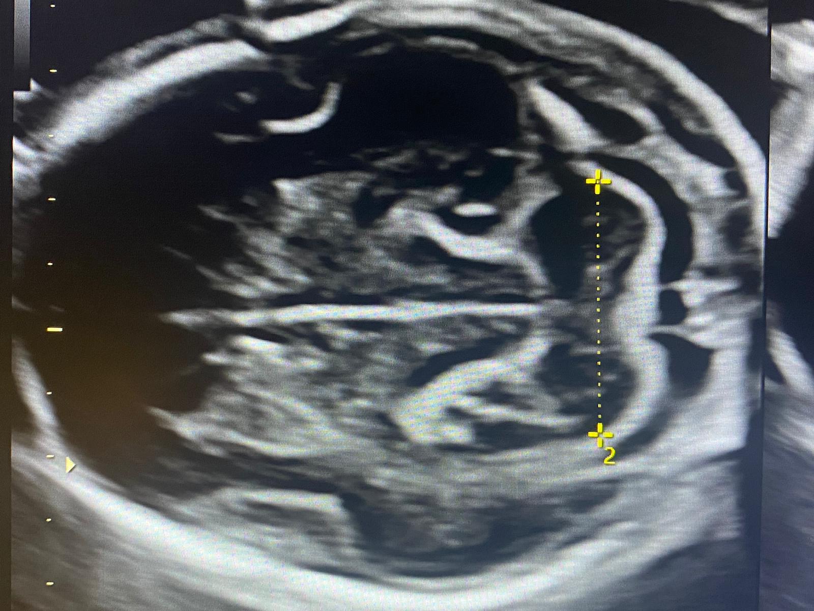 specializzazione morfologica