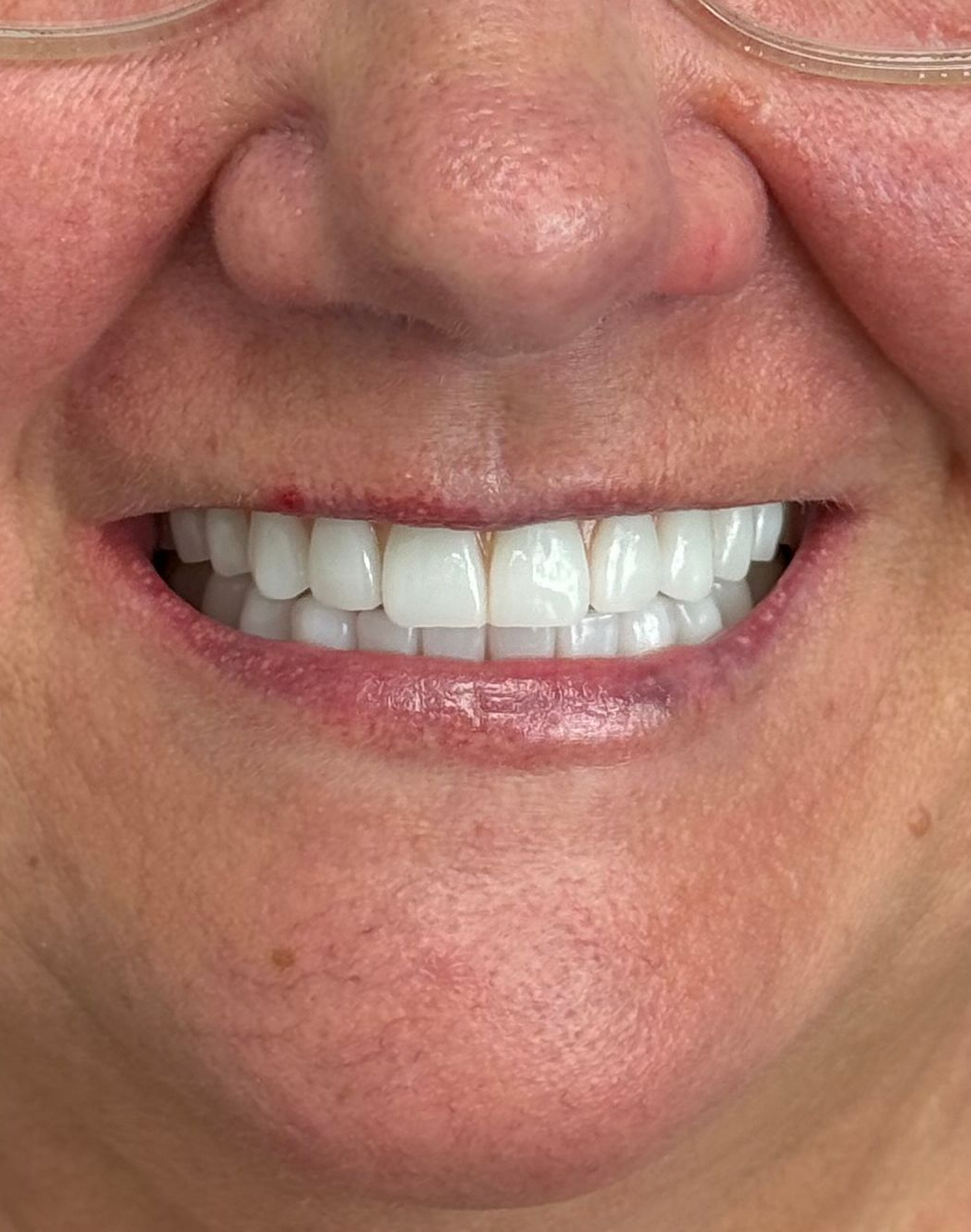 Close-up of a smiling mouth with white teeth and pink lips