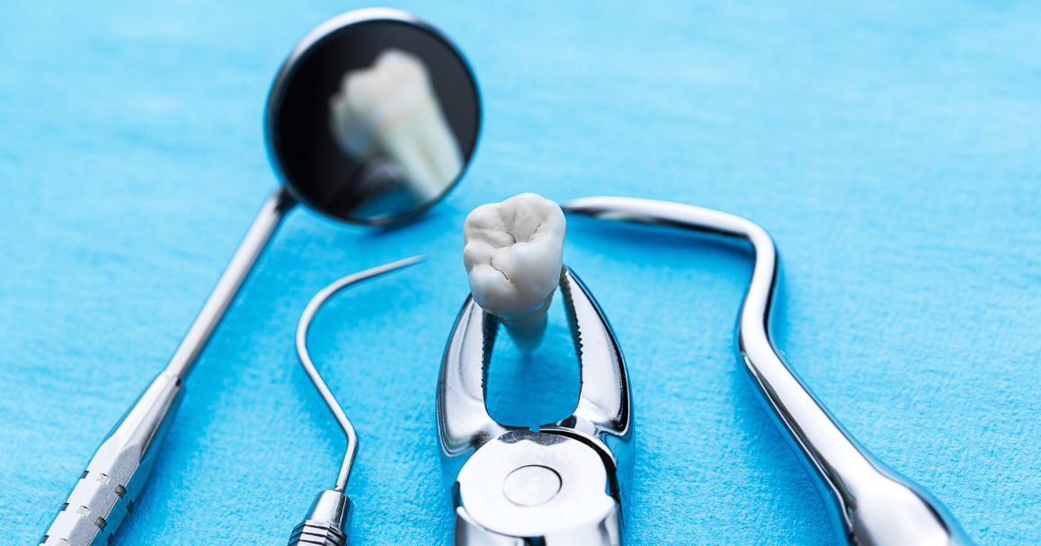 When Is a Tooth Extraction Necessary?