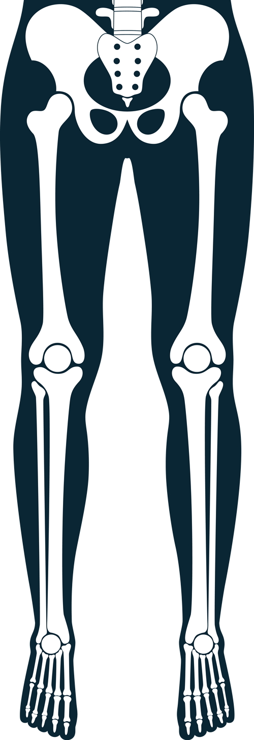 Human Hip and Knee Bones — Ardmore, OK — The Specialty Clinic of Southern Oklahoma