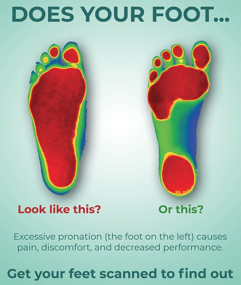 Photo of two feet with trigger points illustrated in colors.