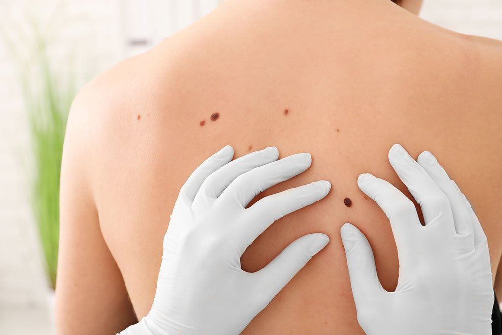 doctor checking the dark spots on patient back