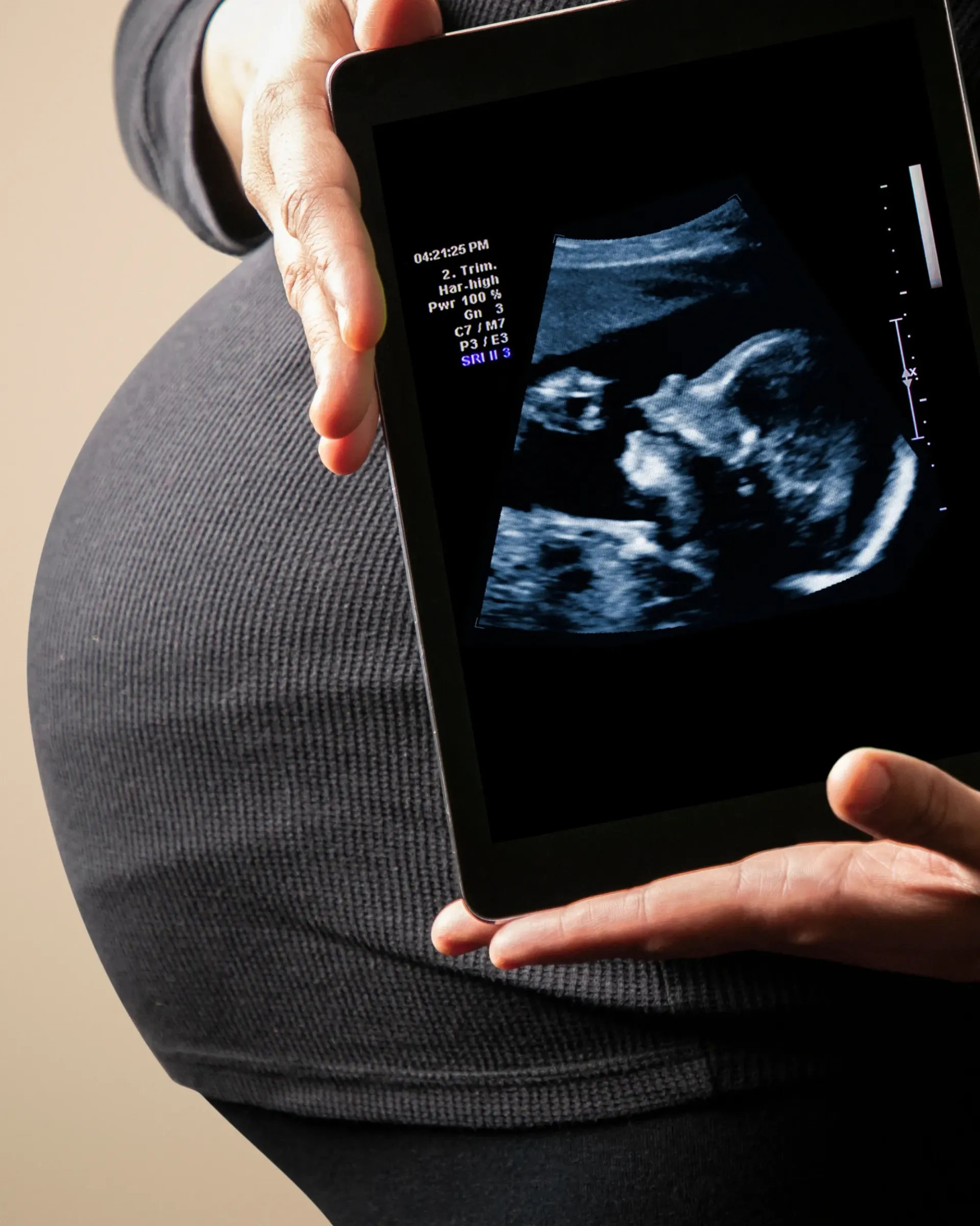 Une femme enceinte tient une tablette avec une échographie dessus
