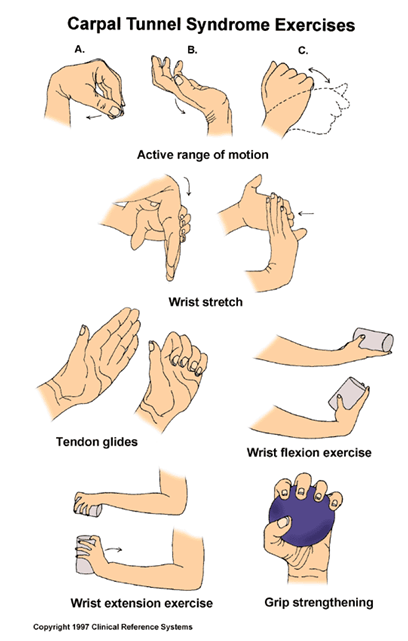 Diagram of hand exercises for carpal tunnel syndrome, demonstrating various stretches and motions.