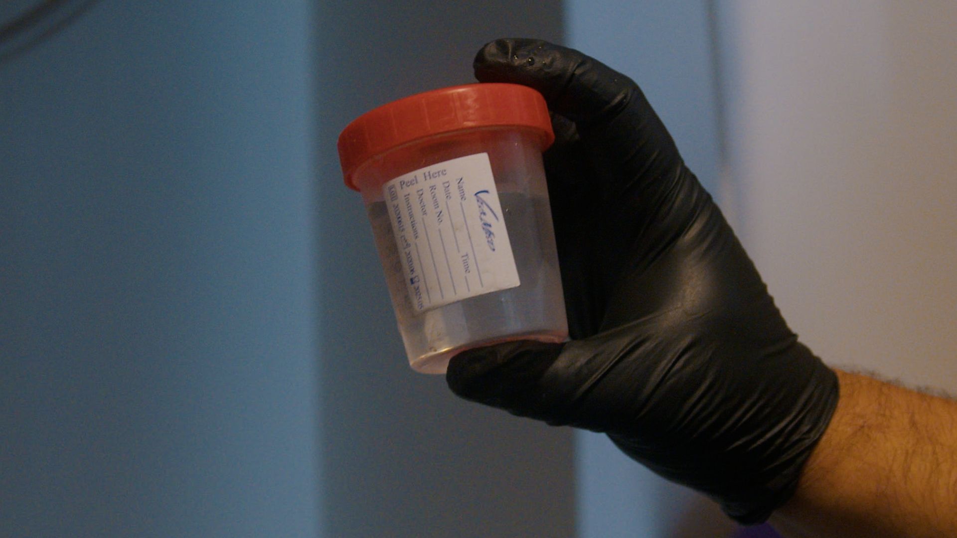 Une personne portant des gants noirs tient un récipient contenant de l'urine.