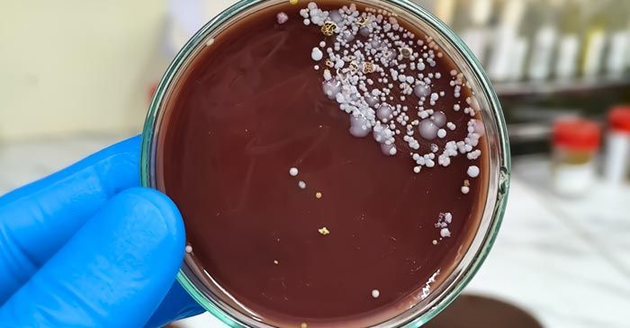 Petri dish with brown agar and white bacterial colonies, held by a gloved hand. Candida Remedies - Dr. Louis Granirer, Holistic Chiropractor
