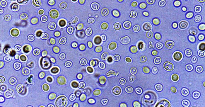 Microscopic view of yeast cells, some with internal structures, in a light blue background.