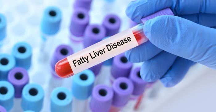 blood test showing Fatty Liver Disease. Fatty Liver Disease Remedies - Dr. Louis Granirer Holistic Chiropractor