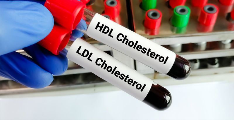 What You Should Know About Cholesterol by Dr. Louis Granirer