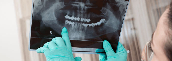 Dental X-Rays Near Edwardsville, IL