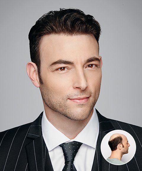 hair salon service to fix bald spots