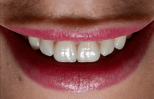 A close up of a woman 's smile with white teeth and red lips.