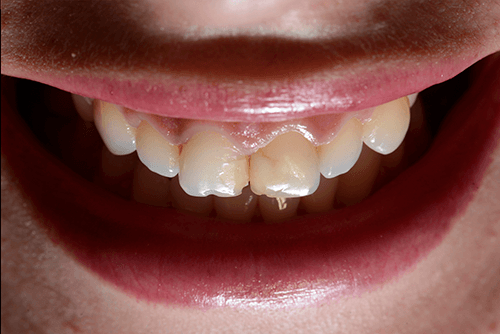 A close up of a person 's teeth and lips.