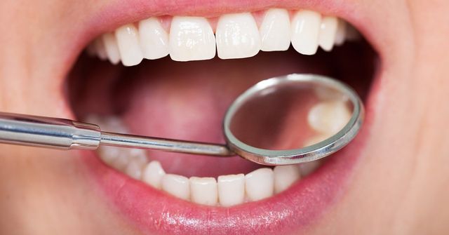 Types Of Dental Fillings  Dental Filling Procedure And Materials