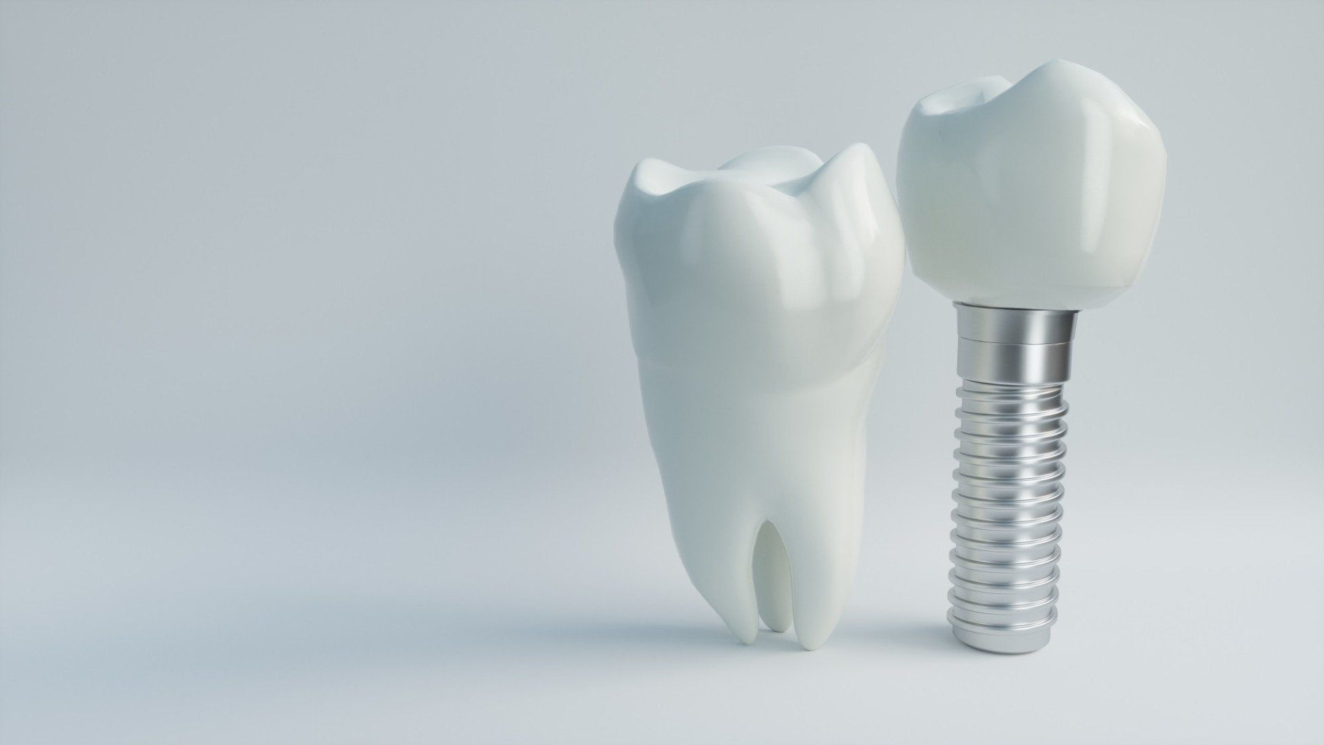Dental Implant Reviews