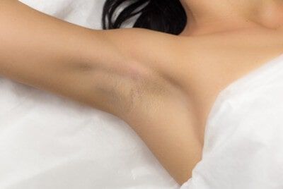 Advanced Electrolysis provides a variety of hair removal services