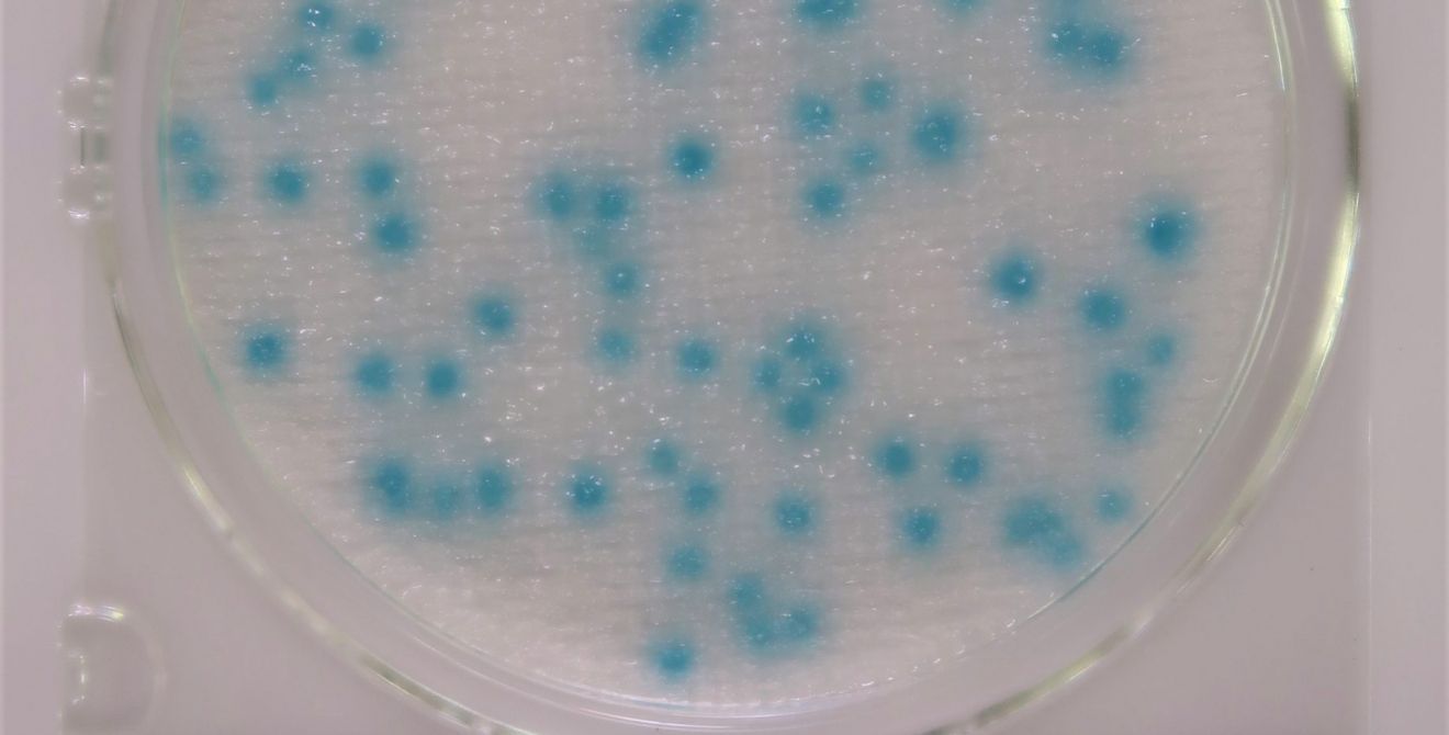 A petri dish filled with blue dots on a white surface.