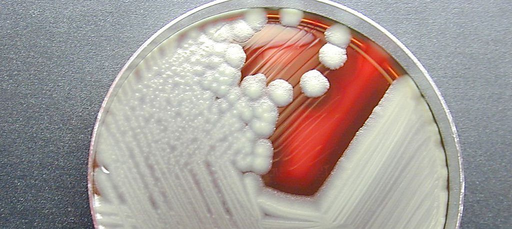 A close up of a petri dish with bacteria on it