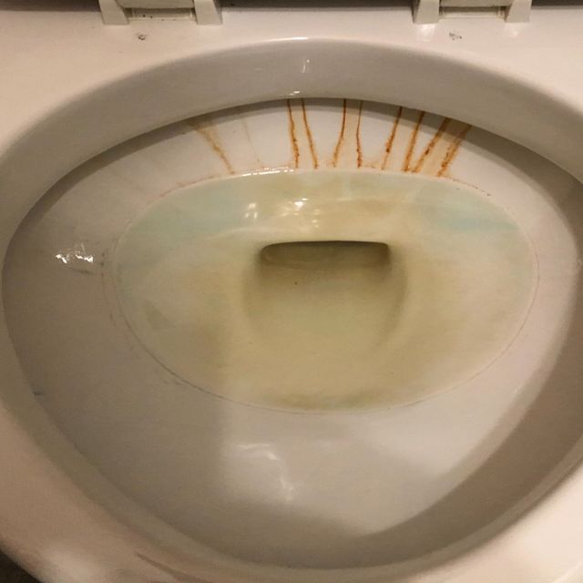 Toilet bowl with brown stains and yellow discoloration.